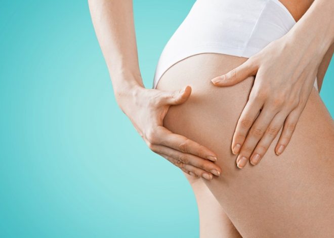 Reduce cellulite with an anti-cellulite diet!
