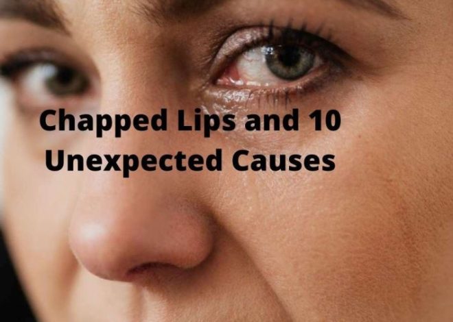 Chapped Lips and 10 Unexpected Causes