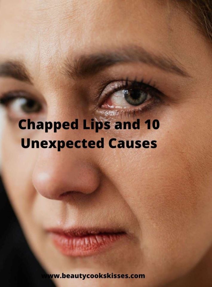 Chapped Lips and 10 Unexpected Causes