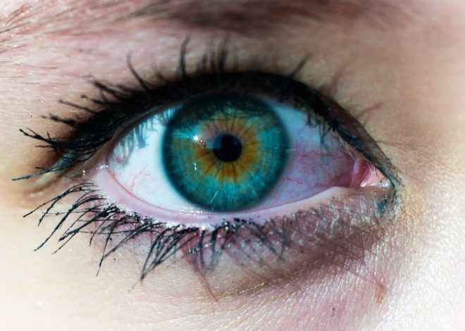 Under Eye Darkness and Reasons for Concealer Disappointment