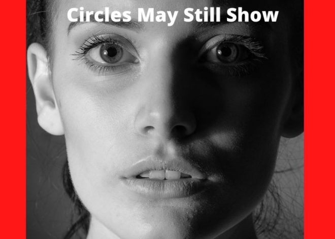 Why Your Under Eye Dark Circles May Still Show