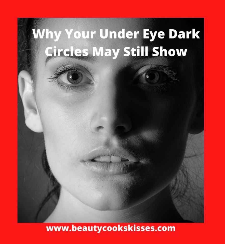 Why Your Under Eye Dark Circles May Still Show