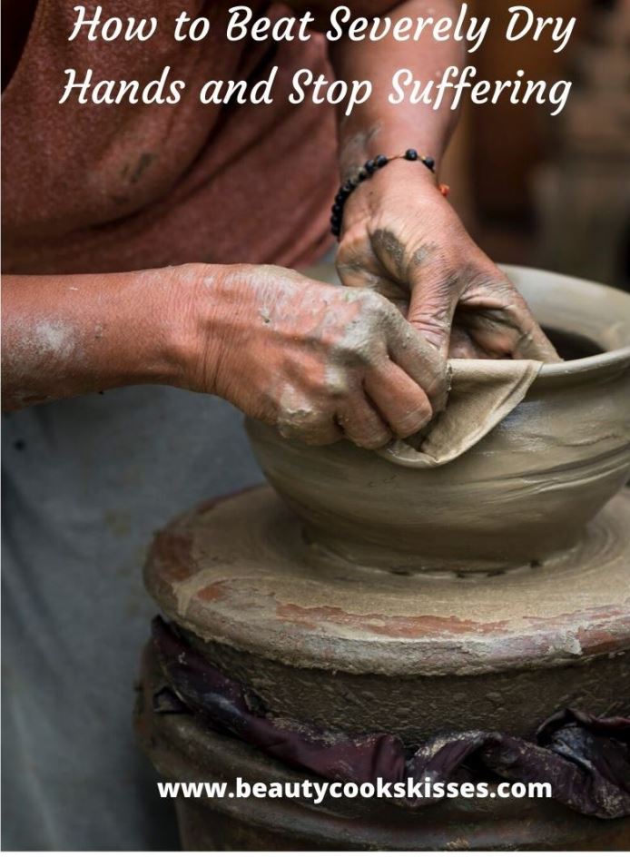 How to Beat Severely Dry Hands