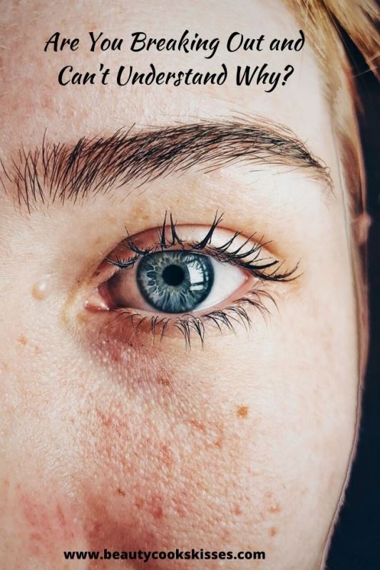 Is Your Skin Breaking Out Without Knowing Why?